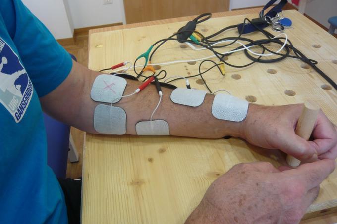 Functional Electrical Stimulation